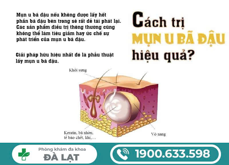Hình ảnh minh họa